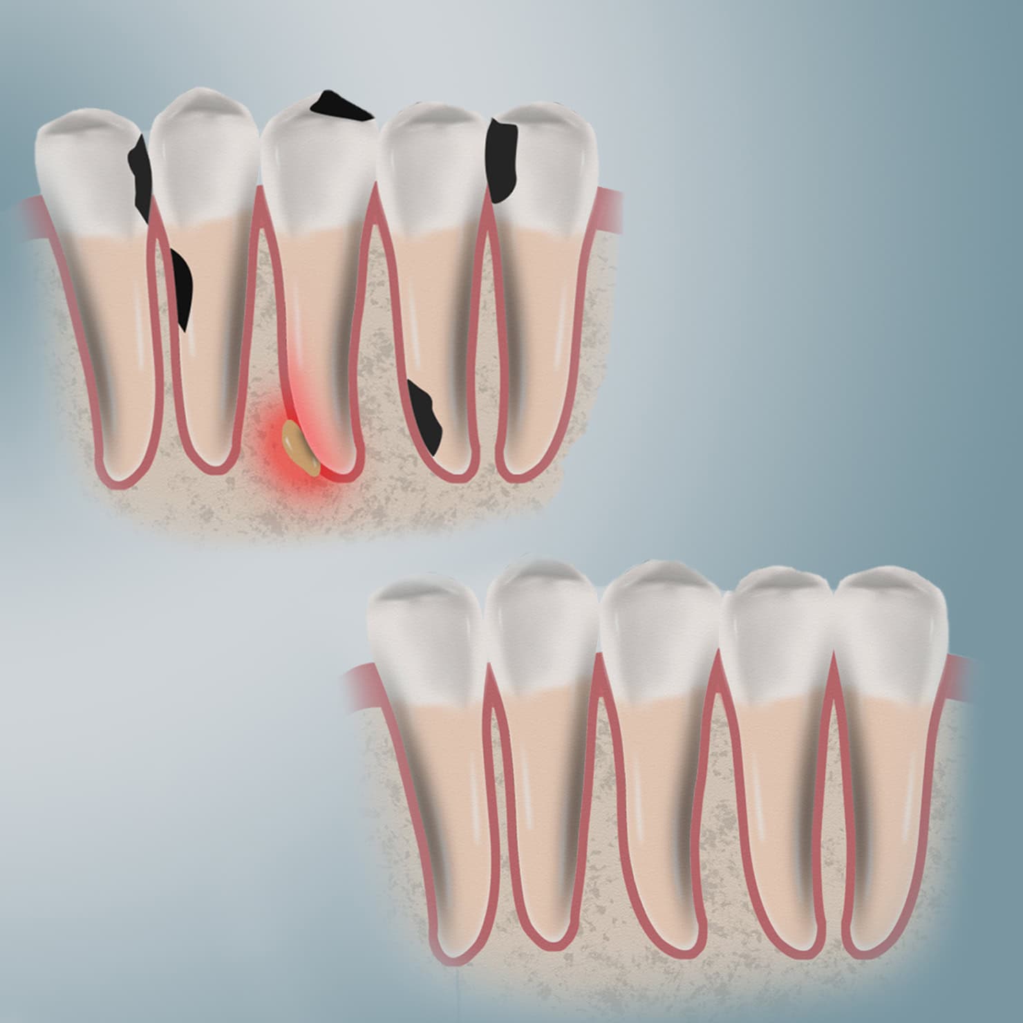 procedure